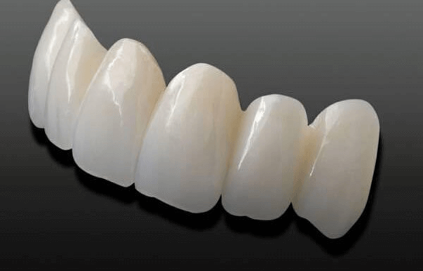 Dental Crown Close-up