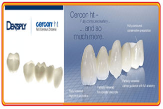 Posterior Dental Crown