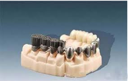 Implant Crown