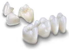Aesthetic Veneer Crown